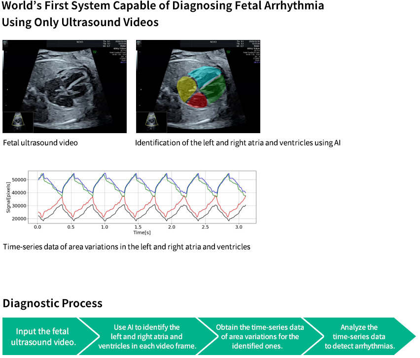 AI-Based Diagnostic Support System for Fetal Arrhythmia Using Ultrasound Videos